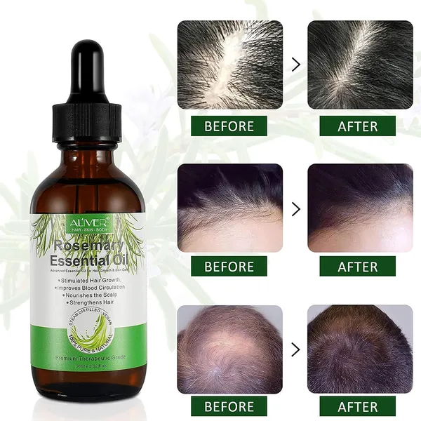 زيت أكليل الجبل لنمو الشعر - Growth Hair Rosemary Essential Oil - الصورة 3